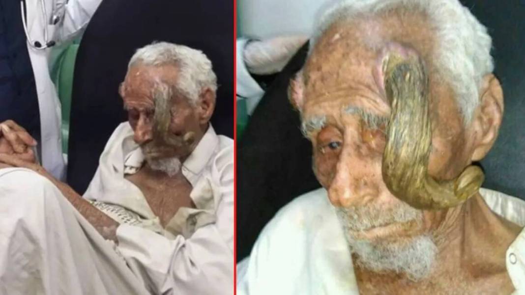 O yaştan boynuzları çıkmıştı! Boynuzlu dededen kahreden haber: Kimse gerçek olduğuna inanmamıştı ama... 4